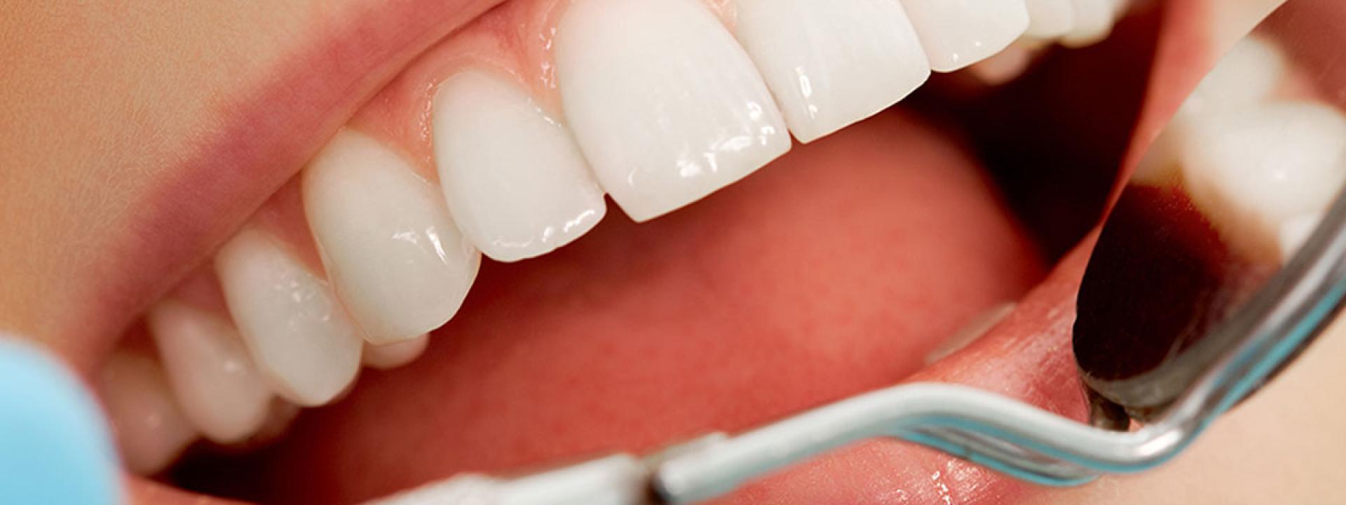 Mouth