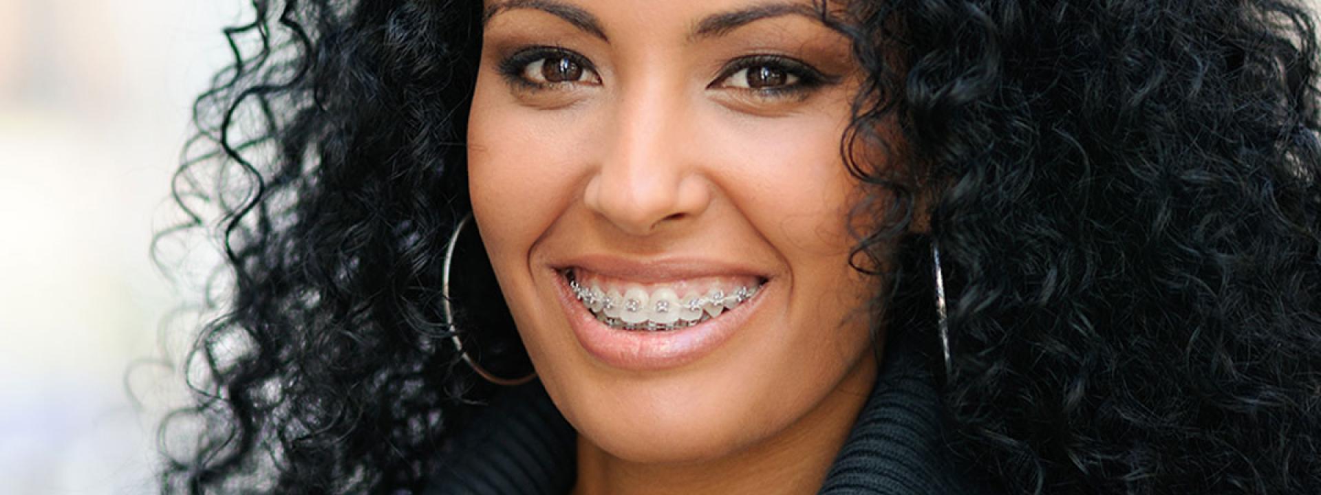 Smiling with braces