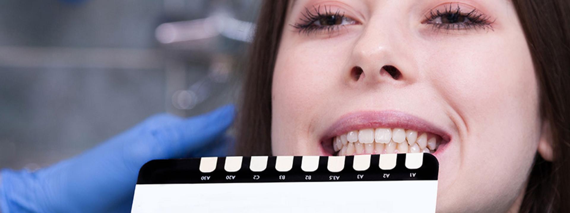 Teeth color checking