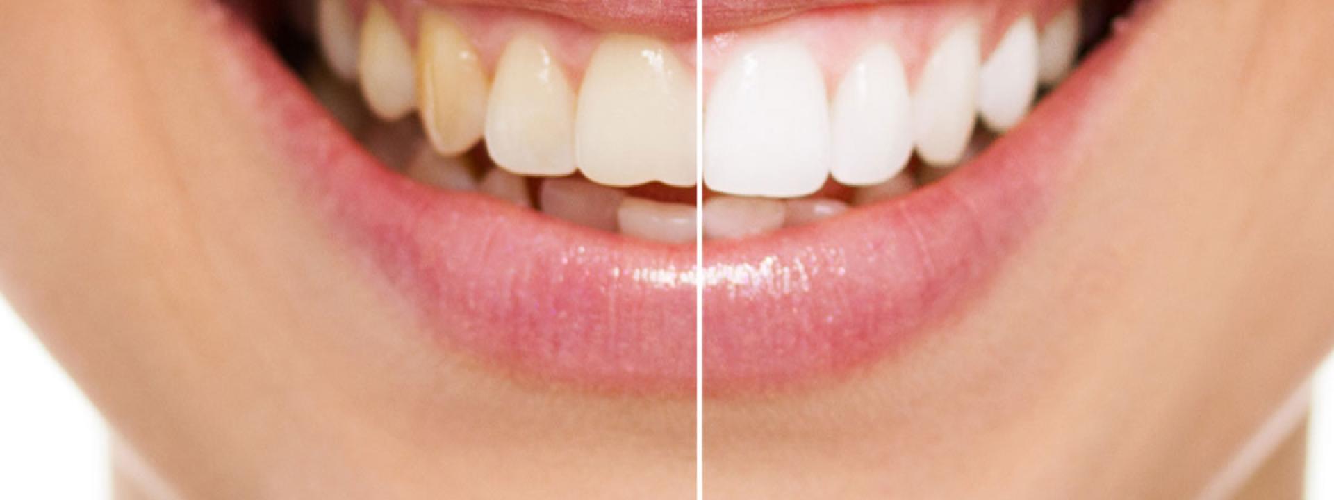 Teeth