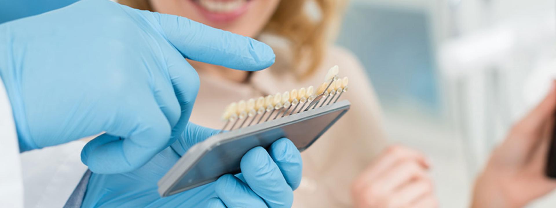 Patient select the color of teeth