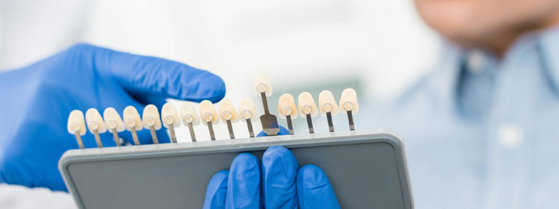 Dental Implant option