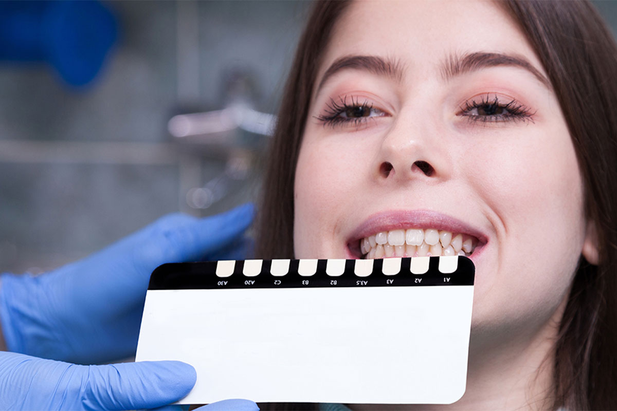 Teeth color checking